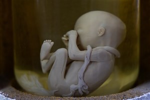 Image description is not available for 1983.69.1